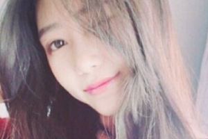 長沙星雅醫(yī)療美容醫(yī)院胡曉健整形價格表附激光祛斑案例展示