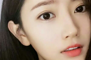 長沙華韓華美醫(yī)學(xué)美容醫(yī)院吳漢斌整形價格表附玻尿酸豐鼻基底案例展示