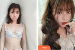 淮南麗人醫(yī)院整形美容科王海龍整形價(jià)格表附自體脂肪隆胸案例展示