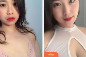 淮南麗人醫(yī)院整形美容科李化訓(xùn)整形價(jià)格表附自體脂肪隆胸案例展示