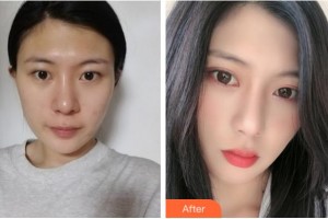 淮南華廈眼科醫(yī)院方玉蘭整形價(jià)格表附眼部綜合案例展示