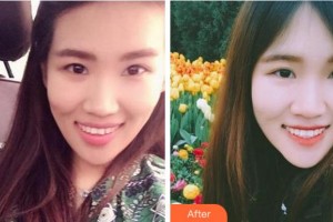 淮南安美口腔門診部承林整形價格表附牙齒隱形矯正案例展示