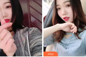 馬鞍山協(xié)志口腔門診部孫家齊整形價格表附牙齒矯正案例展示