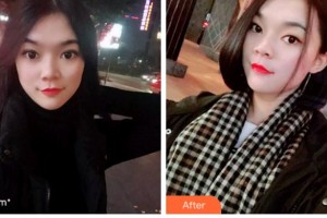 馬鞍山協(xié)志口腔門診部胡義元整形價格表附牙齒隱形矯正案例展示