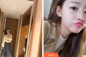 馬鞍山協(xié)志口腔門診部李海春整形價格表附牙齒隱形矯正案例展示