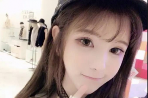 長(zhǎng)沙南湖和睦整形醫(yī)院劉金榮整形價(jià)格表附自體脂肪豐面頰案例展示