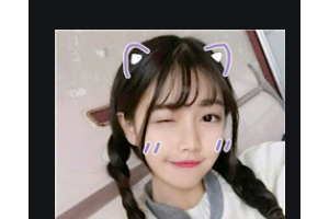 長沙時光醫(yī)療美容醫(yī)院李博整形價格表附自體脂肪全臉填充案例展示