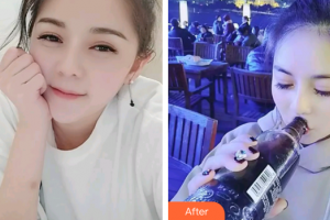 廣州海峽醫(yī)學(xué)整形美容醫(yī)院王釗偉整形價(jià)格表附冷光美白案例展示