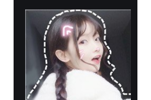 長沙青和醫(yī)療美容診所陳志穎整形價格表附自體脂肪全臉填充案例展示