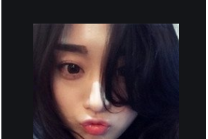 長沙優(yōu)享新天地口腔門診部付麗娟整形價格表附牙齒隱形矯正案例展示