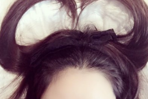 長沙宏朗眼科醫(yī)院胡毅整形價格表附眼部綜合案例展示