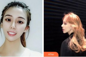 滁州市中西醫(yī)結(jié)合醫(yī)院眼科韓有田整形價(jià)格表附眼部整形案例展示