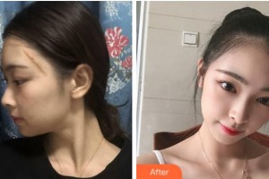 阜陽(yáng)東方美萊塢醫(yī)療美容醫(yī)院勇中華整形價(jià)格表附祛疤案例展示