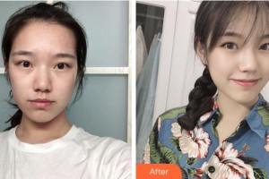 阜陽(yáng)王小妹醫(yī)學(xué)美容整形門(mén)診部王小妹整形價(jià)格表附祛疤案例展示