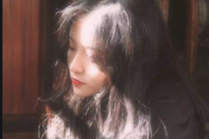 長(zhǎng)沙好牙依口腔?？漆t(yī)院游福海整形價(jià)格表附眼部綜合案例展示