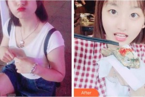 阜陽愛齒口腔門診部蔣成坤整形價格表附美白劑美白牙齒案例展示