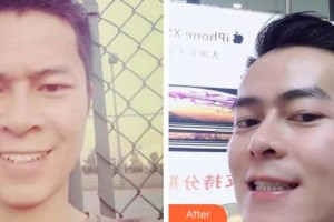 阜陽愛齒口腔門診部韋磊整形價格表附金屬托槽矯正案例展示