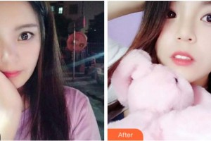 阜陽愛齒口腔門診部趙艷整形價格表附牙齒矯正案例展示