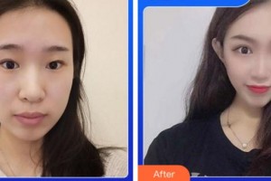 阜陽澤明眼科醫(yī)院王利平整形價格表附眼部綜合案例展示