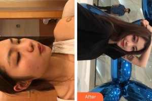 宿州康麗醫(yī)療美容門診部李夢義整形價格表附光子嫩膚案例展示