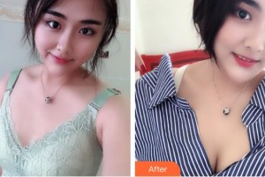 宿州天使醫(yī)療美容門診部路宏波整形價格表附隆胸案例展示