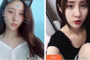 宿州惠爾美整形美容醫(yī)院陳麗華整形價格表附祛斑案例展示