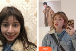 六安市人民醫(yī)院醫(yī)學(xué)美容中心李傳勇整形價格表附眼部整形案例展示