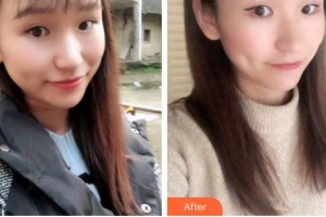 六安皖美口腔門診部馬曉春整形價格表附牙綜合案例展示