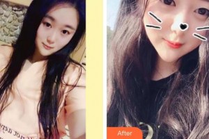 亳州康美口腔醫(yī)院武春勤整形價(jià)格表附牙齒矯正案例展示