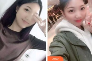 亳州郭琳口腔診所李賀整形價(jià)格表附牙綜合案例展示