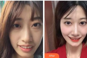 亳州郭琳口腔診所周秀琴整形價(jià)格表附牙齒美白案例展示