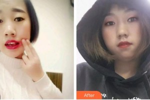 亳州嚴(yán)秀口腔診所趙冰川整形價(jià)格表附牙綜合案例展示