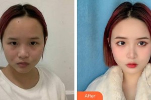 池州伊尚美醫(yī)療美容門(mén)診部孫開(kāi)全整形價(jià)格表附激光美膚祛斑案例展示