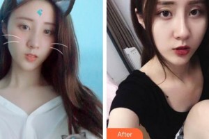 池州佳美皮膚美容醫(yī)院孟憲兵整形價格表附激光祛斑案例展示