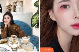 宣城眼科醫(yī)院查敦傳整形價格表附眼部綜合案例展示