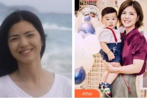 宣城為民口腔門診部王縱波整形價格表附牙齒隱形矯正案例展示