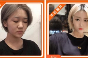 浙江大學(xué)醫(yī)學(xué)院附屬第二醫(yī)院整形科許鳳芝整形價(jià)格表附鼻部綜合案例展示