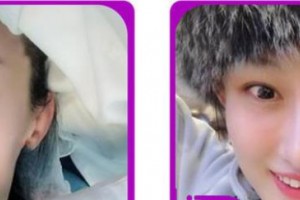 浙江大學(xué)醫(yī)學(xué)院附屬口腔醫(yī)院胡軍整形價(jià)格表附冷光美白案例展示