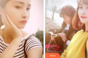 浙江大學(xué)醫(yī)學(xué)院附屬口腔醫(yī)院蔡霞整形價(jià)格表附美白貼片案例展示