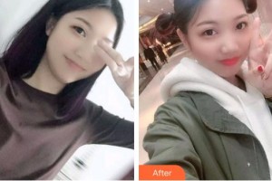 浙江大學(xué)醫(yī)學(xué)院附屬口腔醫(yī)院陳民棟整形價(jià)格表附牙齒根管調(diào)節(jié)案例展示