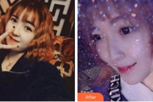 浙江大學(xué)醫(yī)學(xué)院附屬口腔醫(yī)院吳夢婕整形價(jià)格表附超聲波潔牙案例展示