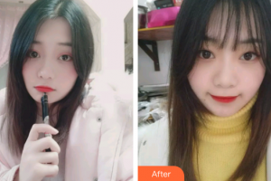 廣州圣貝口腔門診部萬千整形價格表附時代天使矯正案例展示