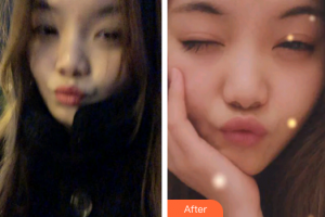 廣州圣貝口腔門診部蔡菁菁整形價格表附時代天使矯正案例展示