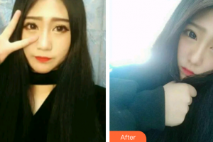 廣州穗華口腔醫(yī)院張修學整形價格表附時代天使矯正案例展示