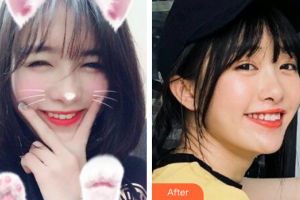 廣州穗華口腔醫(yī)院謝曉聰整形價格表附牙齒美白案例展示