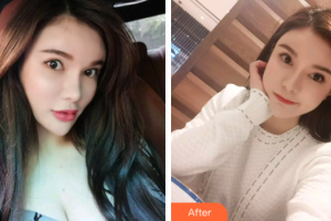 廣州穗華口腔醫(yī)院林逸心整形價格表附超聲波潔牙案例展示