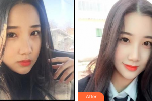 廣州穗華口腔醫(yī)院王俊杰整形價格表附冷光美白案例展示