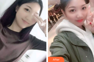 廣州暨博口腔醫(yī)院李艷平整形價格表附牙齒根管調(diào)節(jié)案例展示