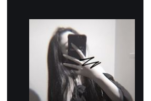 衡陽雅美醫(yī)療美容醫(yī)院袁妍妍整形價格表附玻尿酸精華導(dǎo)入案例展示