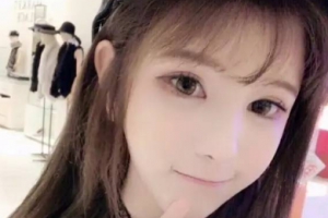 衡陽雅美醫(yī)療美容醫(yī)院王曉朋整形價格表附鐳射凈膚案例展示